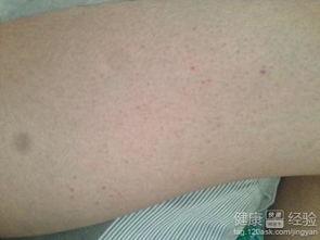 紫癜可以吃茄瓜,茄瓜的营养与益处