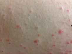 紫癜可以吃茄瓜,茄瓜的营养与益处